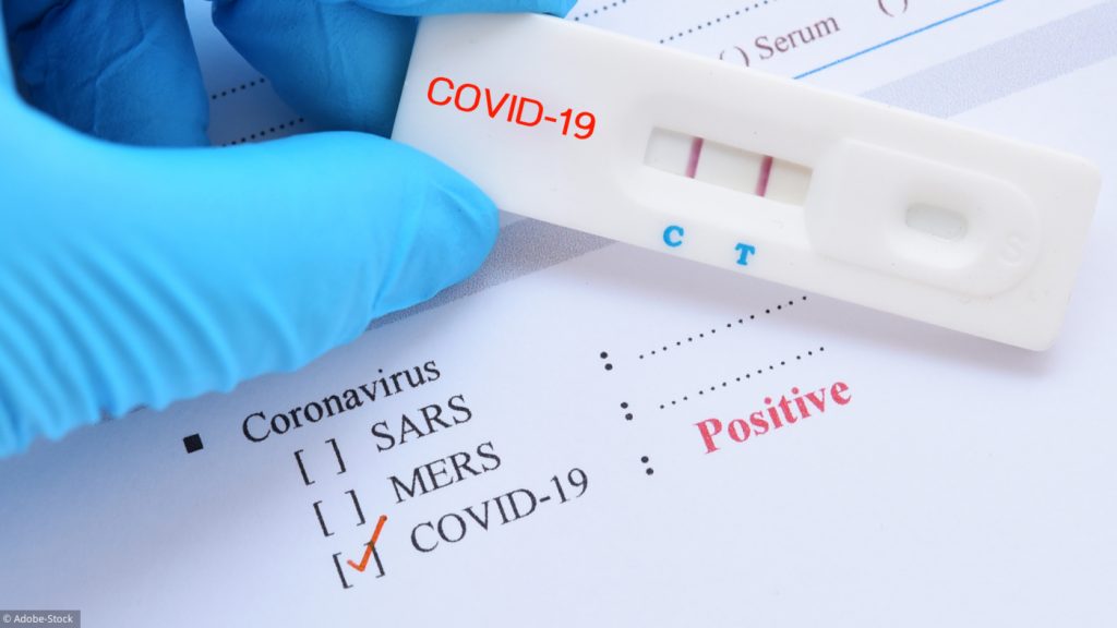 coronavirus tests ace000cee8029b1ca76be7c03db77531