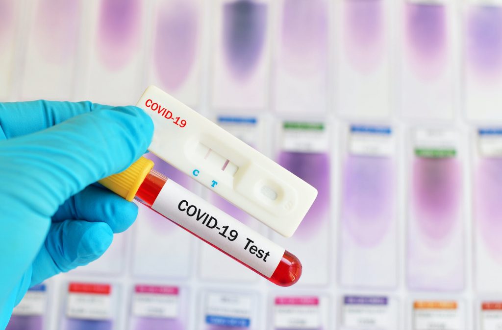 test coronavirus covid 19